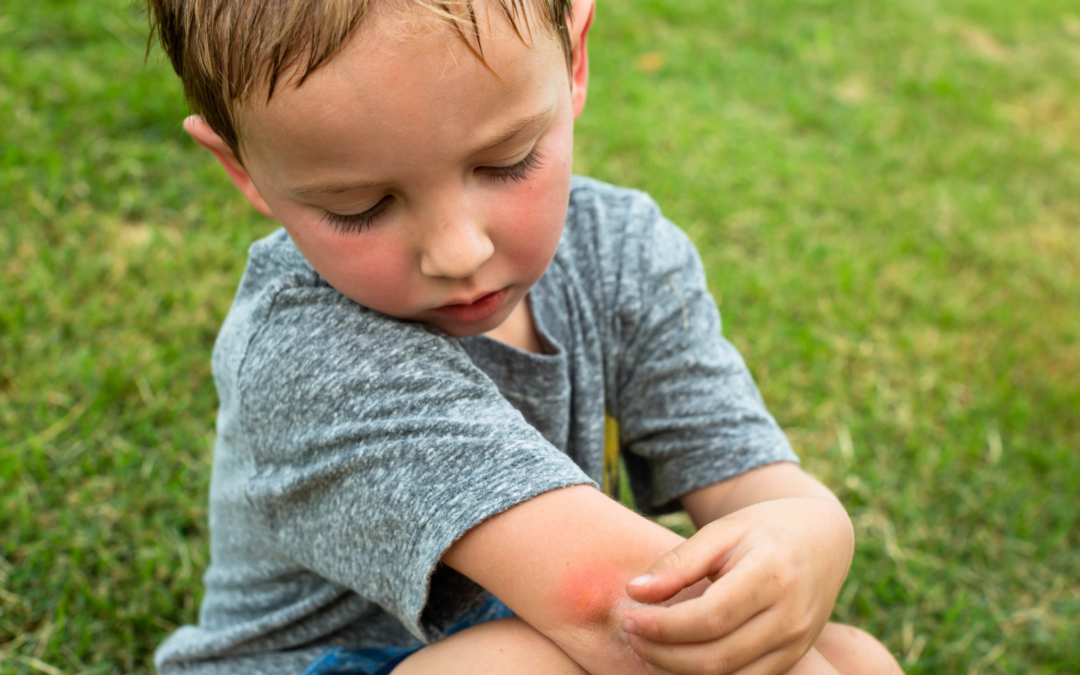 Child outside with a bug bite